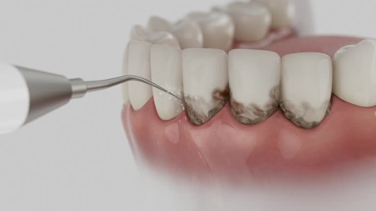 Trusted Emergency Dentist service in Covington, LA - Dentist Open Now